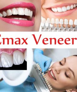eMax Porcelain Veneers|premium emax Dental Veneers wholesale source price